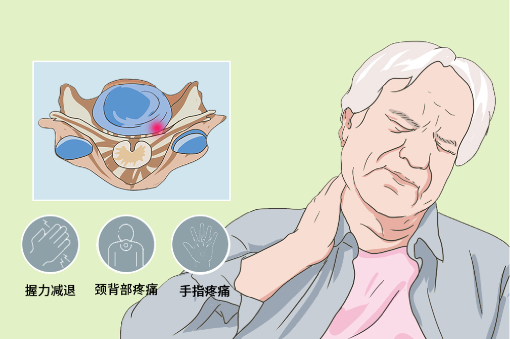 邵陽創(chuàng)傷骨科,邵陽風濕病區(qū),邵陽骨質增生,邵陽關節(jié)病區(qū),邵陽頸椎病區(qū)
