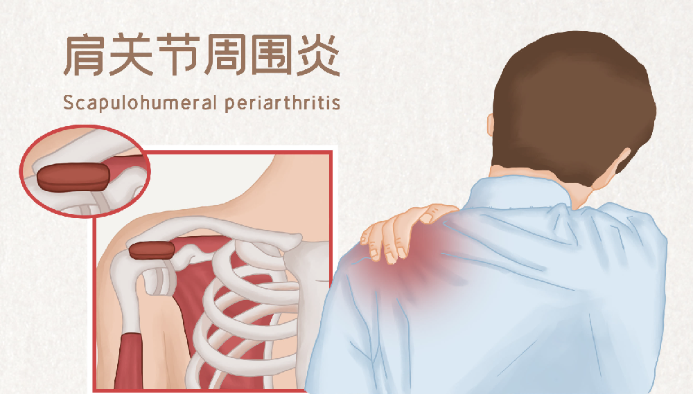 邵陽創(chuàng)傷骨科,邵陽風(fēng)濕病區(qū),邵陽骨質(zhì)增生,邵陽關(guān)節(jié)病區(qū),邵陽頸椎病區(qū)