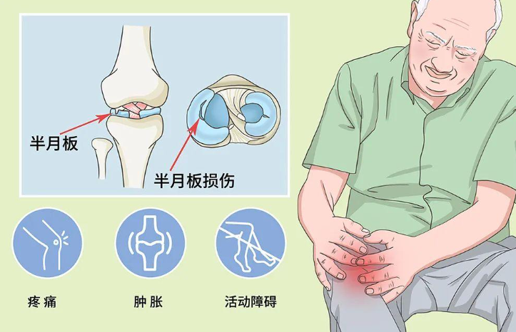 邵陽創(chuàng)傷骨科,邵陽風濕病區(qū),邵陽骨質(zhì)增生,邵陽關(guān)節(jié)病區(qū),邵陽頸椎病區(qū)