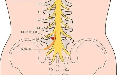 邵陽創(chuàng)傷骨科,邵陽風濕病區(qū),邵陽骨質(zhì)增生,邵陽關節(jié)病區(qū),邵陽頸椎病區(qū)